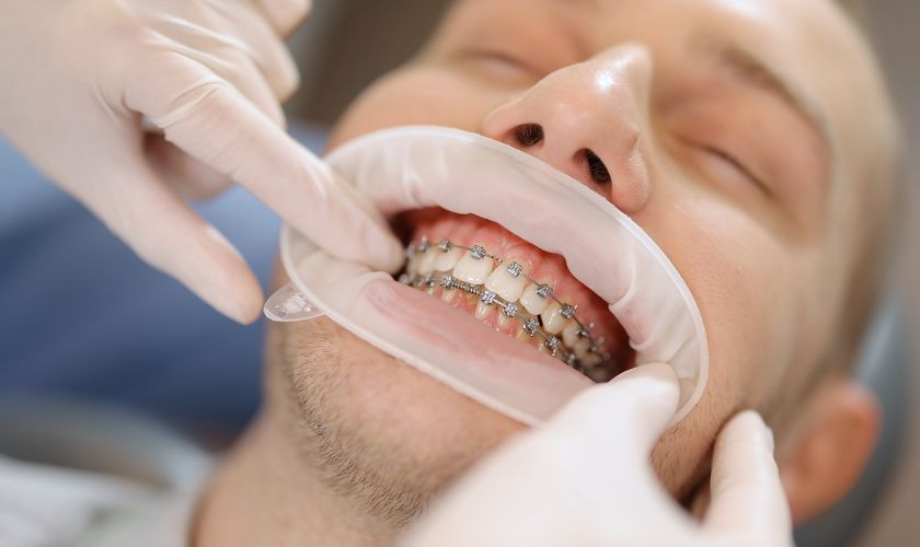 Surgical Orthodontics