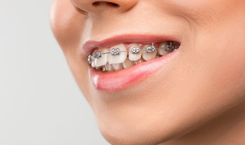 orthodontics