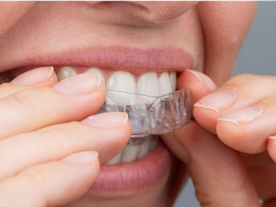 Invisalign in Niceville