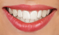 clear aligners in Brockport and Rochester NY