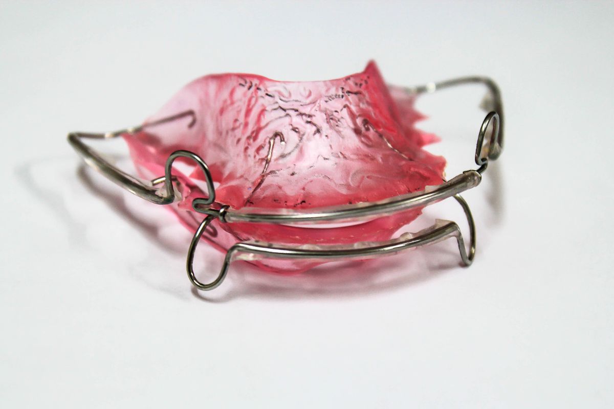 orthodontic retainer sample image