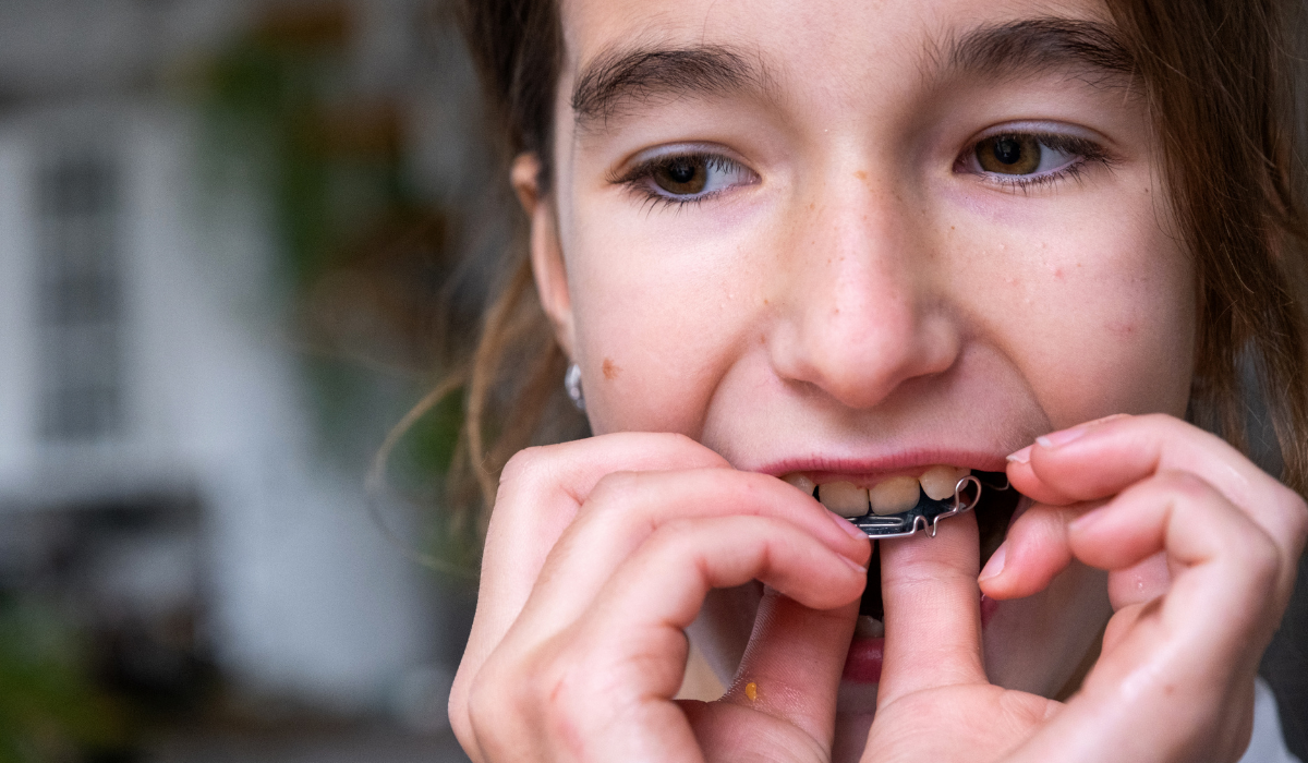 Young patient demonstrating crossbite alignment issue with finger placement on teeth.
