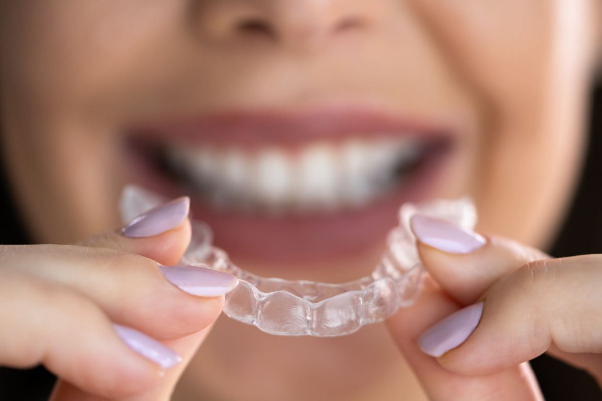 clear aligner tray