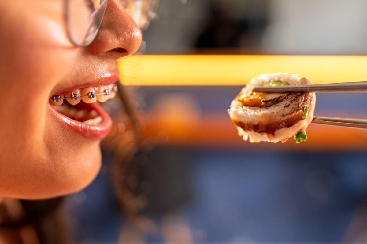 foods to eat with braces