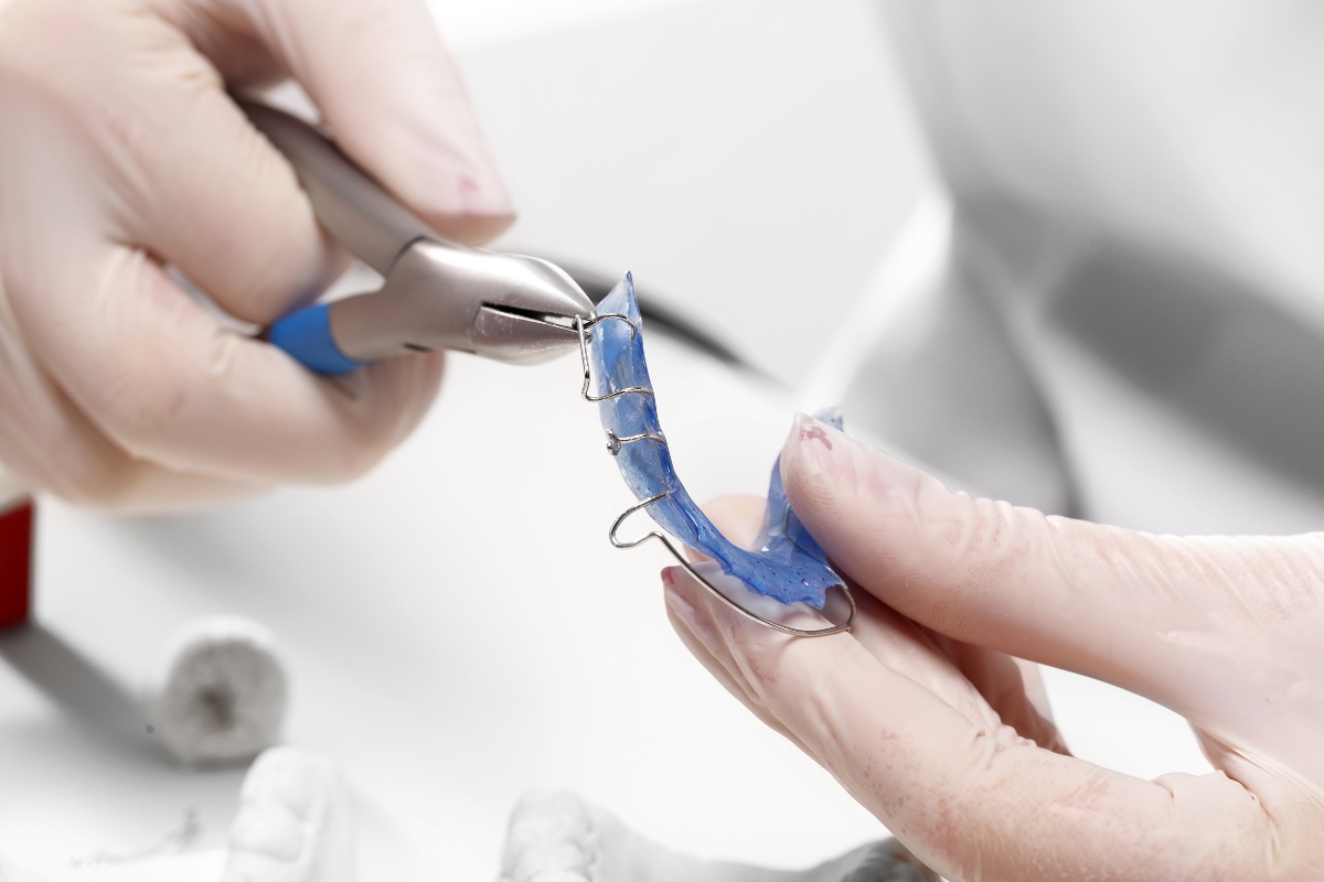 Orthodontic Appliances: Palatal Expanders and Space Maintainers