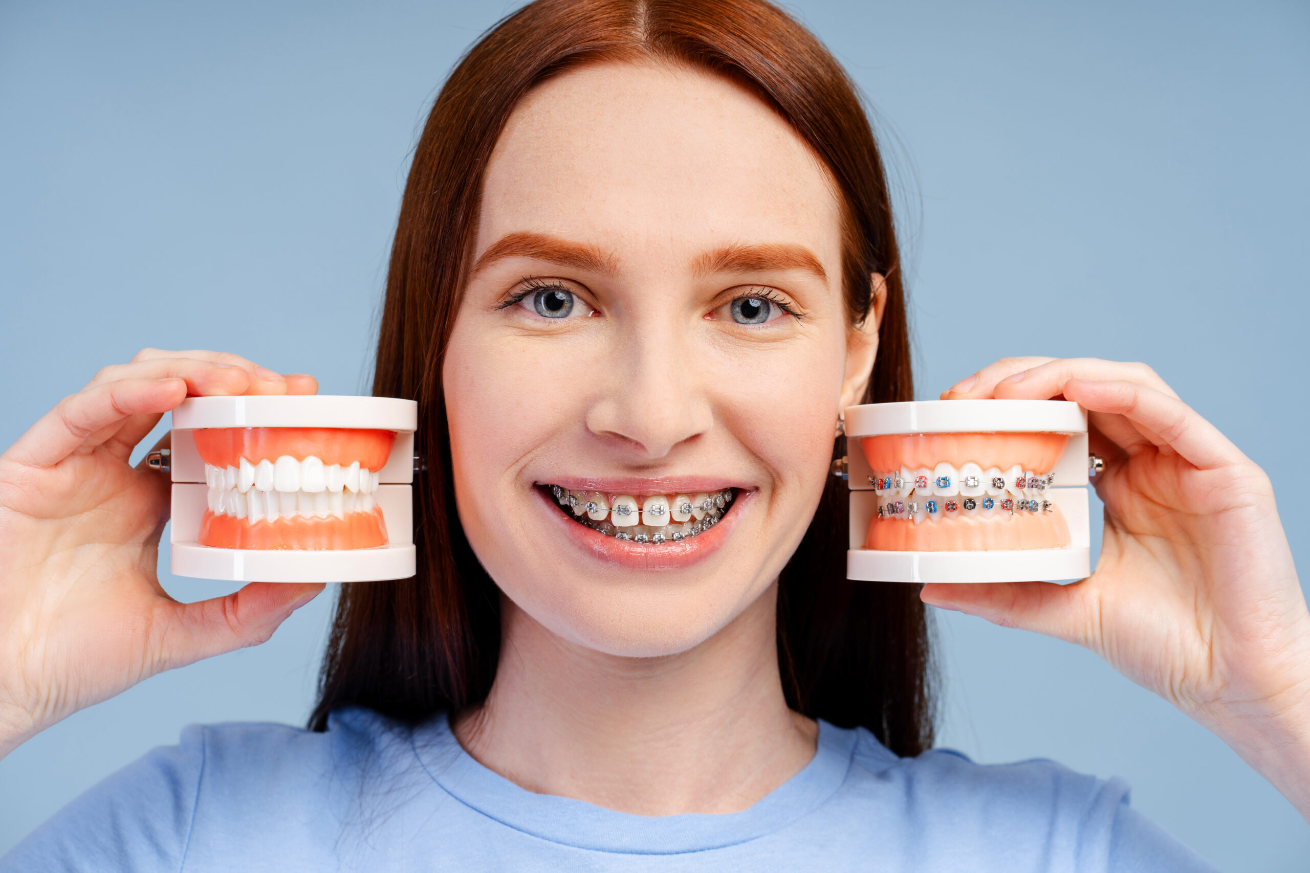 Straightening Your Teeth with Braces