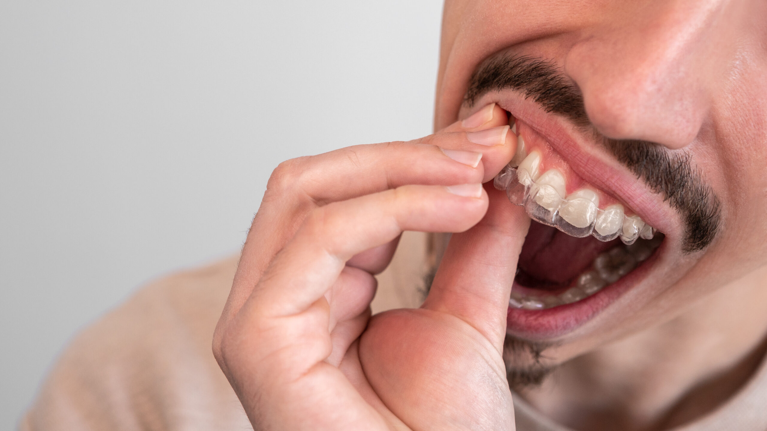 Tips for Managing Discomfort During the First Week of Clear Aligners