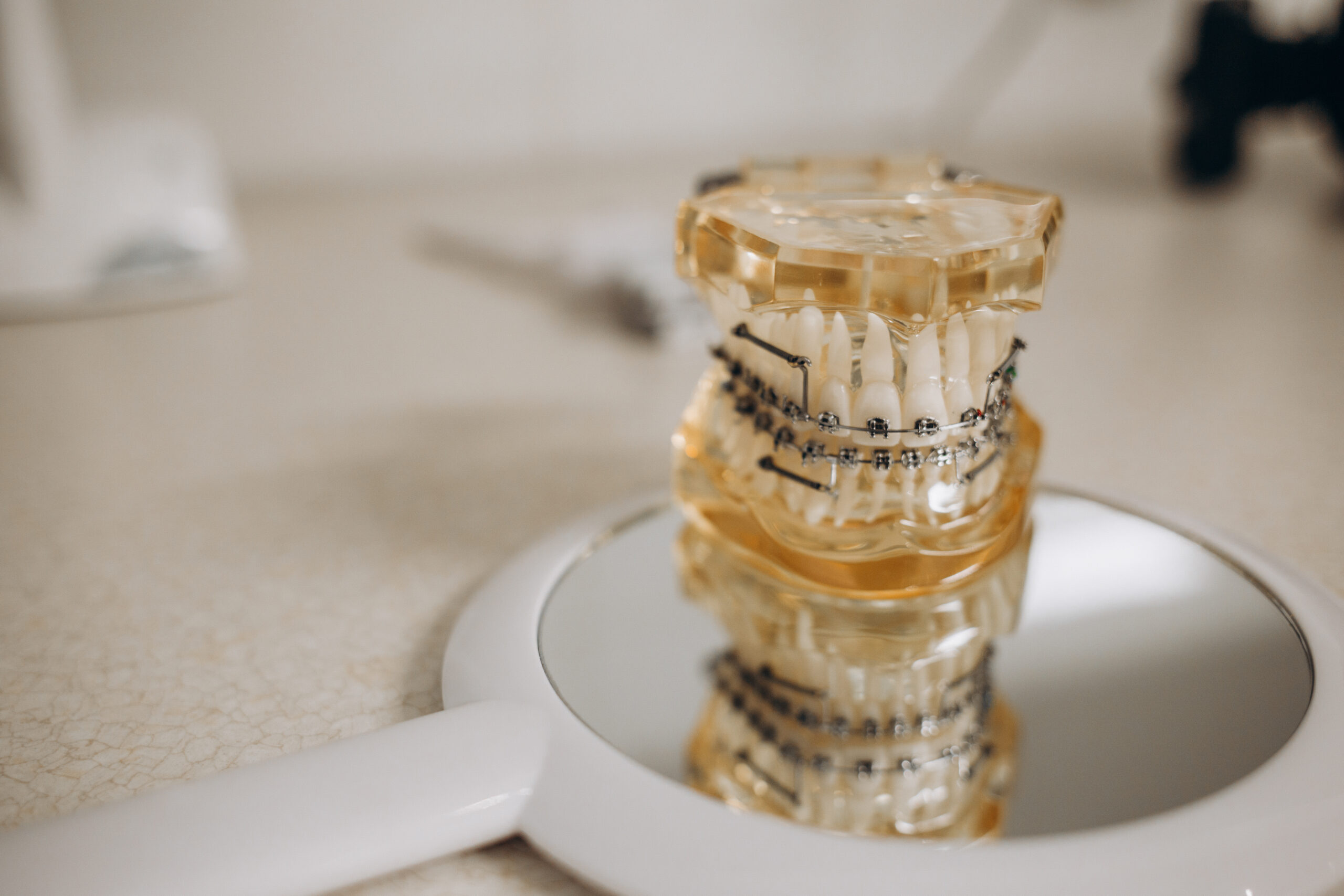 Clear Aligners Have Become the Preferred Choice for Adults - Dentist Guide