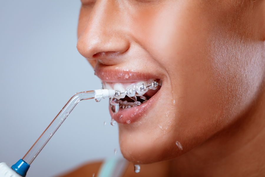 Invisalign for Overbite, Underbite, and Crossbite