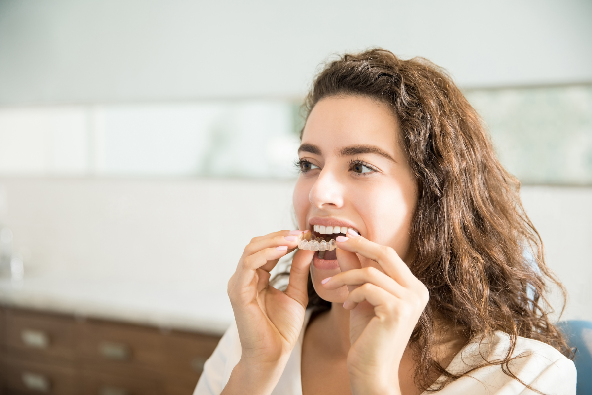 Clear Aligners (Invisalign)