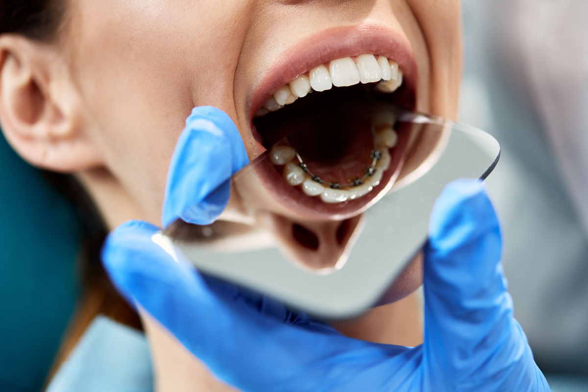 Monthly Orthodontic Adjustments