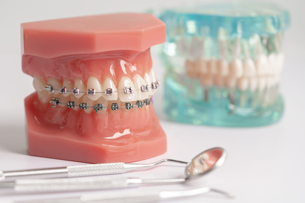 Orthodontics in Brockport